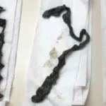 Clarexin Intestinal Parasite Cleanse review user 1 - 2