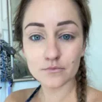 Clarexin drops review user 1