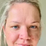 Clarexin review user 1