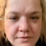 Clarexin review user